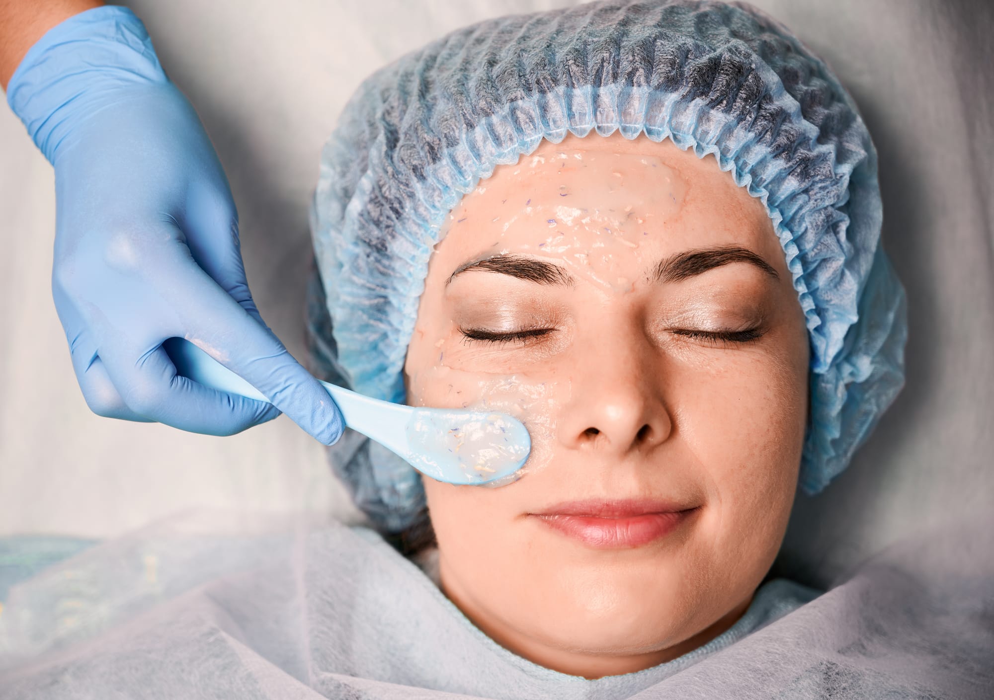 Chemical Peels in Rawalpindi – Types, Benefits, and Aftercare
