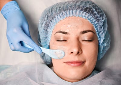 Chemical Peels in Rawalpindi – Types, Benefits, and Aftercare