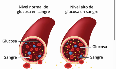 Tipos de diabetes