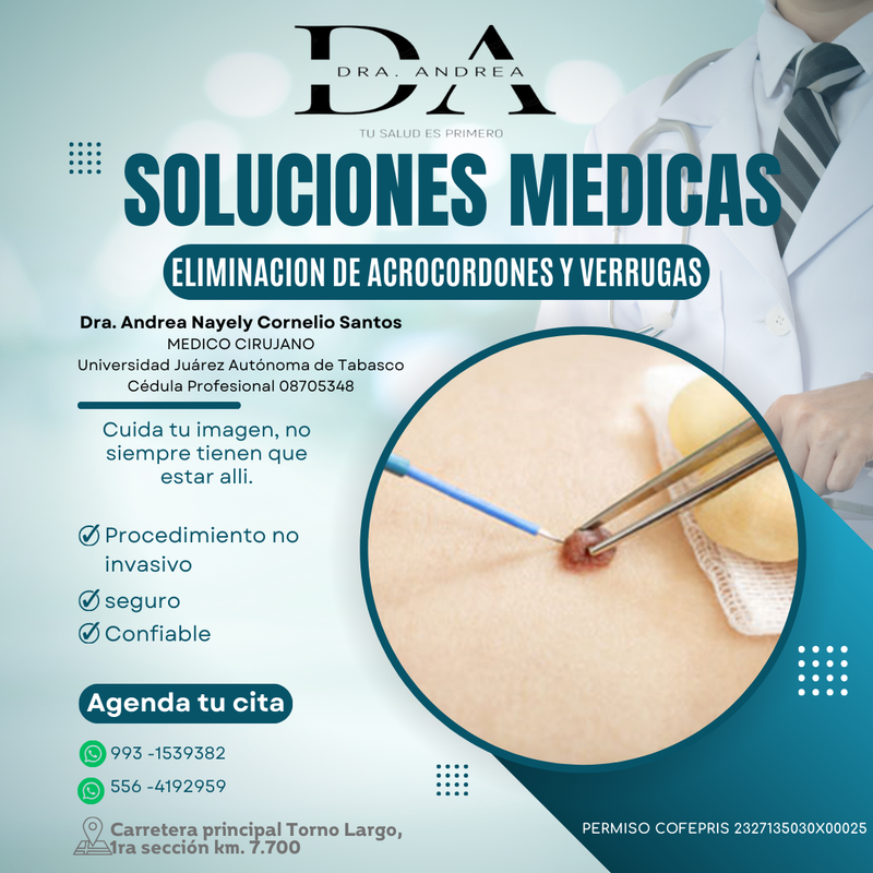 Retiro de verrugas comunes y acrocordones.