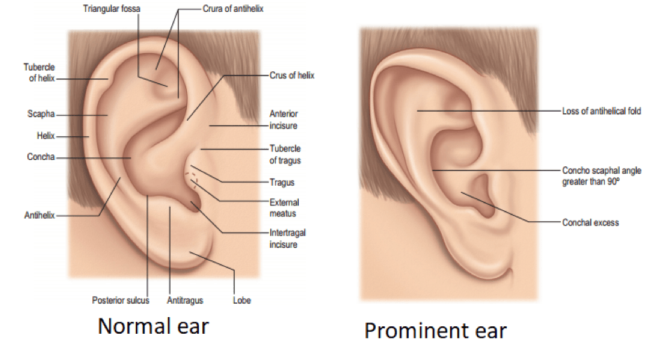 ear plastic surgery