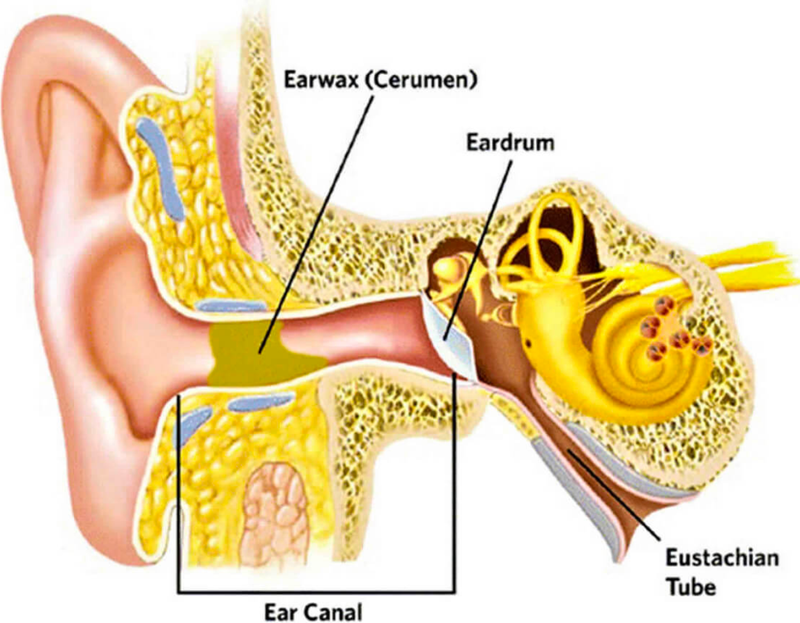 Olive Oil, Sodium Bicarbonate or  Hydrogen Peroxide for Ear Wax?