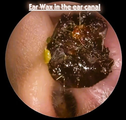 Did you know your ears are actually self cleaning?