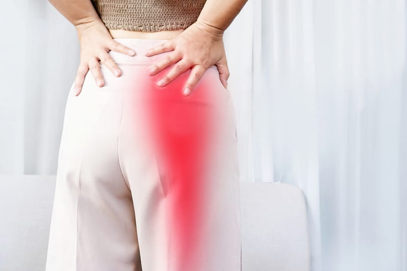 sciatica