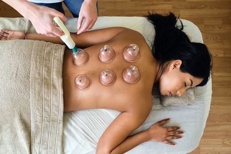 Dry cupping