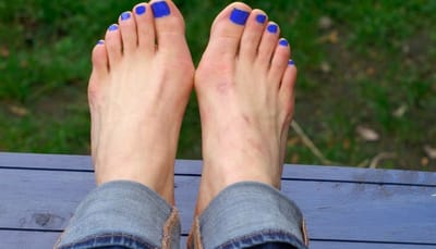 Do bunion correctors work