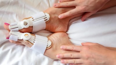 Best Bunion Corrector