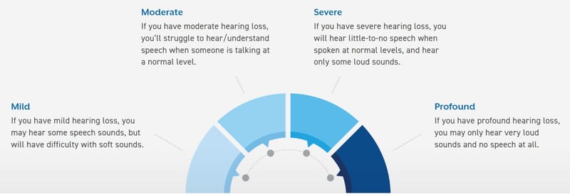 Degree of hearing loss.