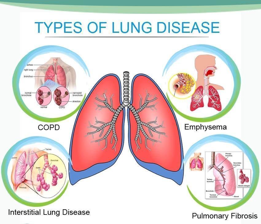 Raga-Chakra therapy and pulmonary issues