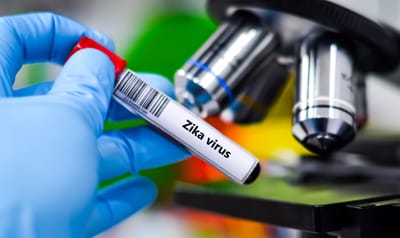 Pensão especial para crianças com microcefalia: o que você precisa saber para garantir este direito