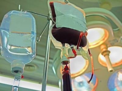 BT Set Medical: Essential Tools for Safe and Efficient Blood Transfusion Practices
