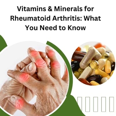 Vitamins & Minerals for Rheumatoid Arthritis: What You Need to Know