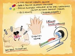 Essential Tremor Treatment Without Surgery: What Are Your Options?