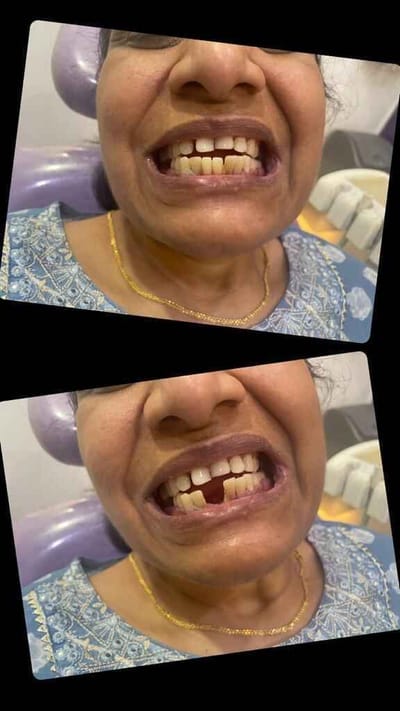 Dental Clinic in Noida, Sector 137: Your Trusted Partner for Oral Health