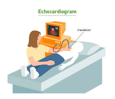 2 D ECHO CARDIOGRAPHY