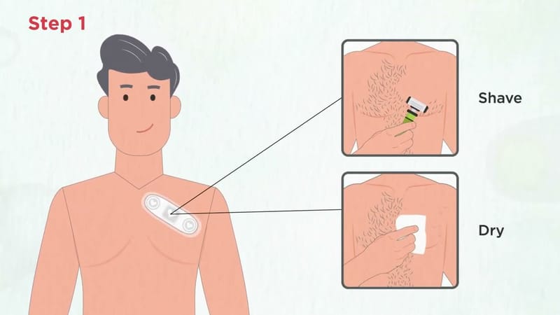 HOLTER STUDY(72-168 HRS)