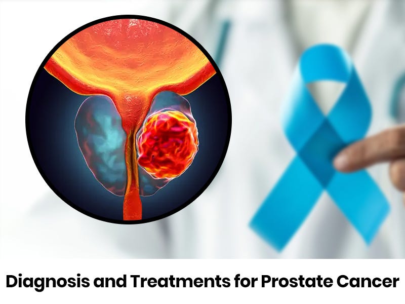 PROSTATE CANCER