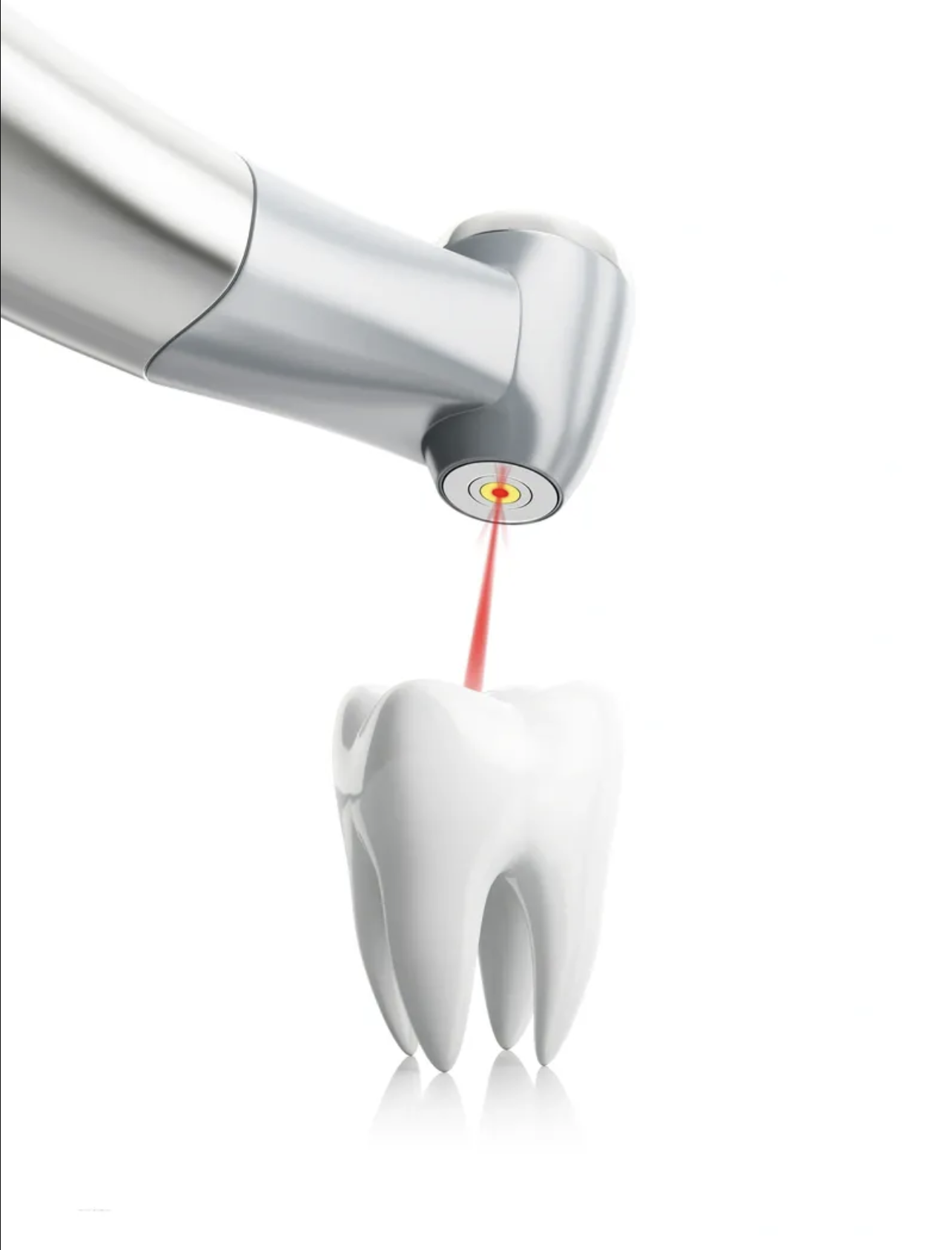 LASER USE IN DENTISTRY