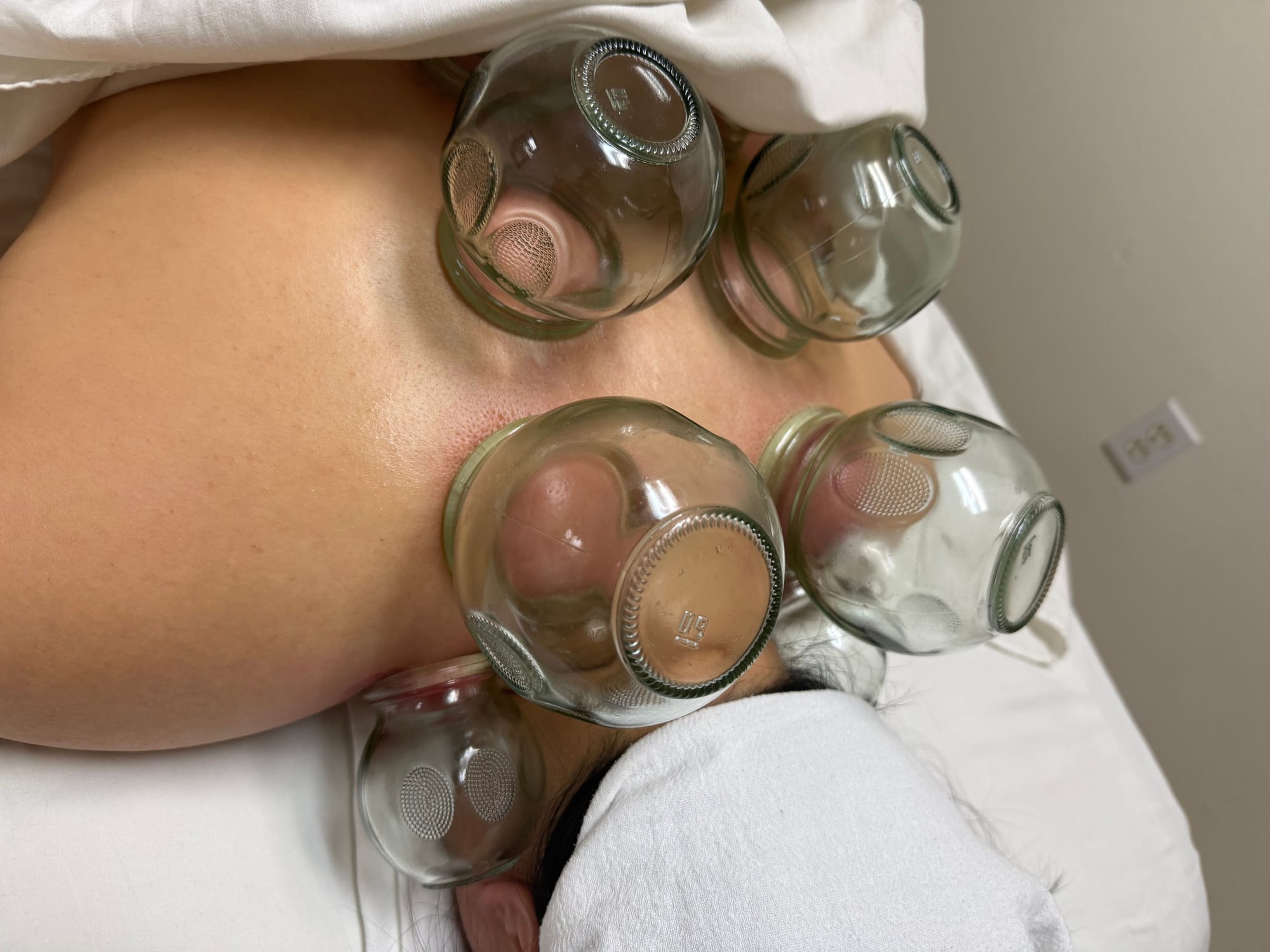 Cupping Therapy helps relax your muscles and increase blood circulation!