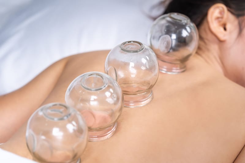 Many people who've had cupping therapy report that it: