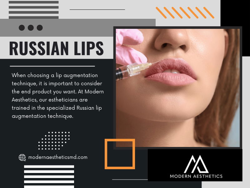 Russian Lips