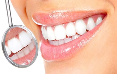 Professional Teeth Whitening for You