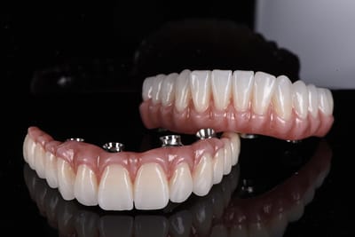 Innovative Dental Implant Practice Treatment Techniques