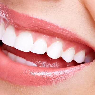 Smile Makeovers Begin at Our Dental Implant Practice