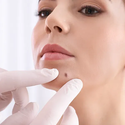 What is the suffix for biopsy?