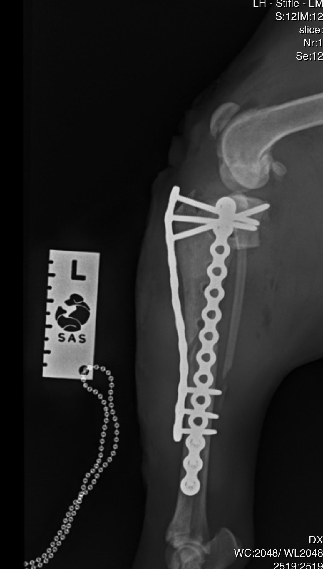 Revision Surgery Post Failed TPLO