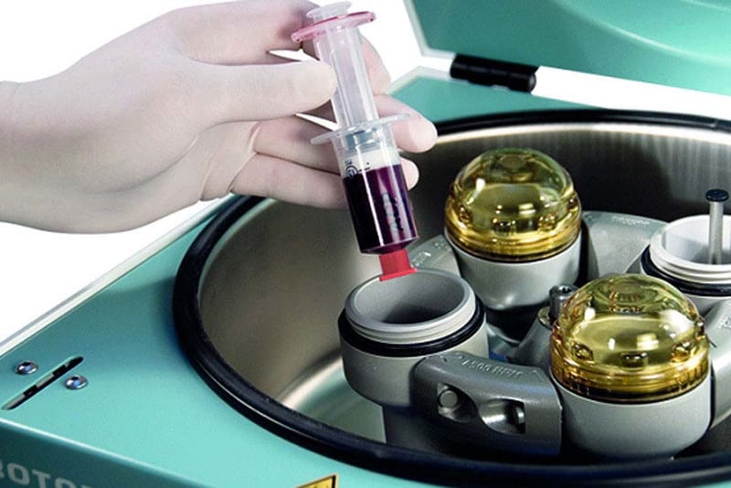 REGENERATIVE MEDICINE