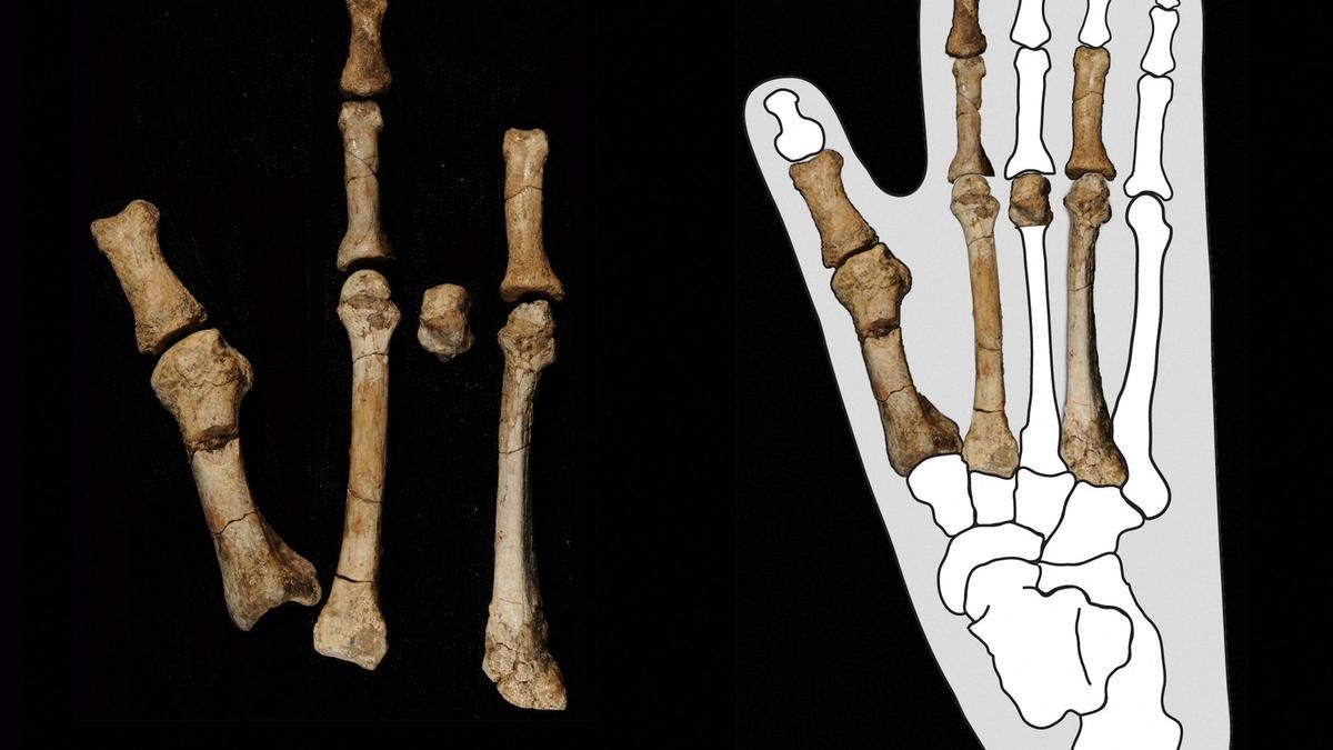 Scientists solve mystery of prehistoric ‘Burtele Foot’