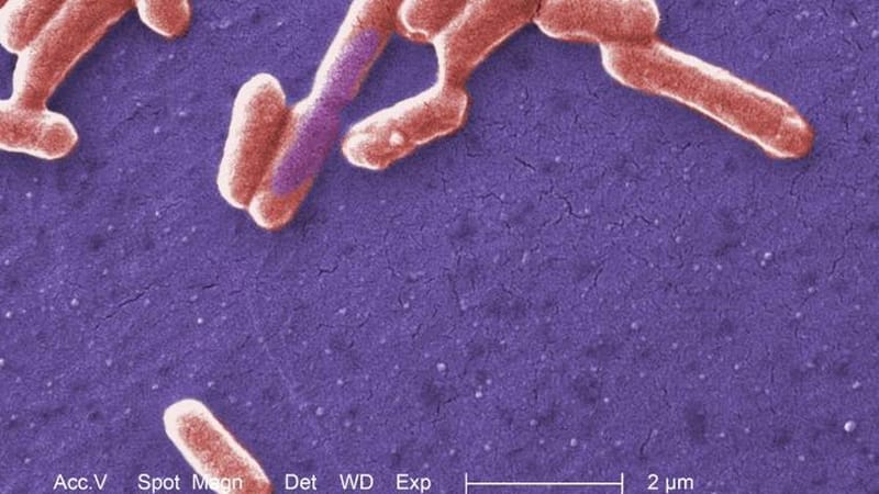 Scientists turn E. coli bacteria into a mercury sensor