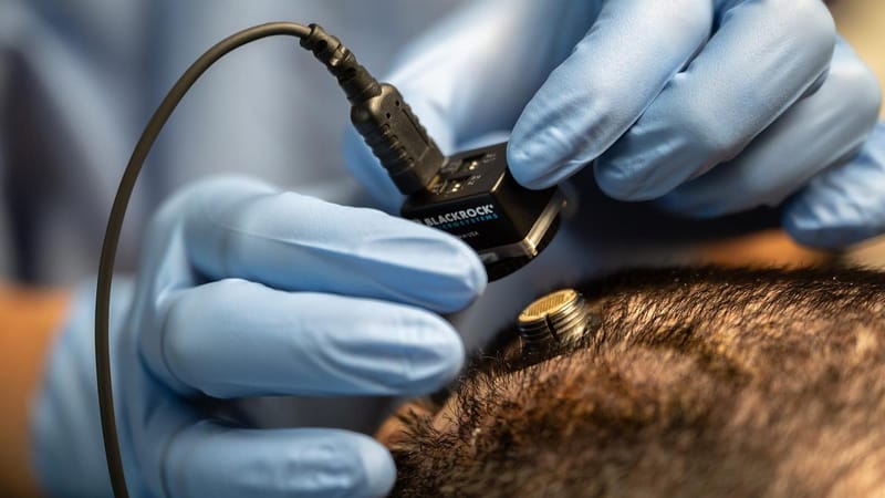 UNESCO’s New Global Recommendations on Neurotechnology