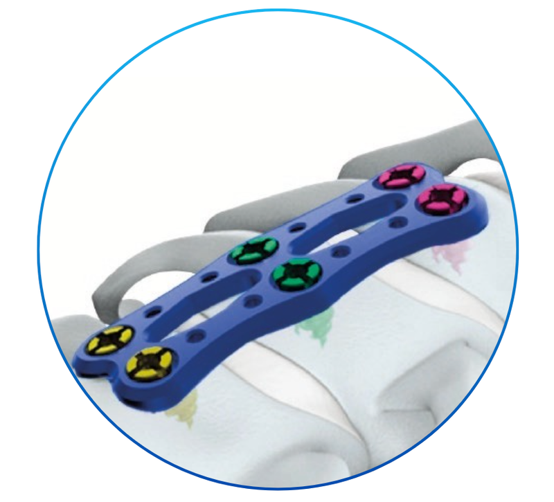 PLACAS CERVICAL ANTERIOR