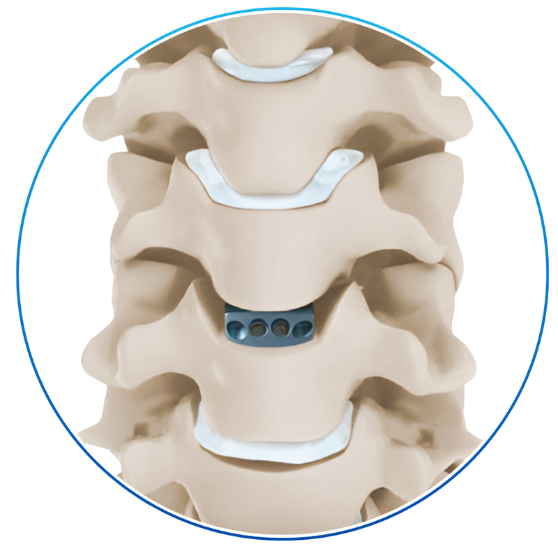 CAJA INTERSOMÁTICA 4 TORNILLOS