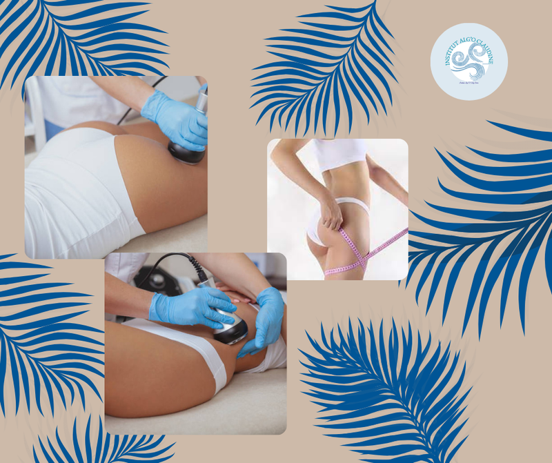 CARTE LIPOCAVITATION ET RADIOFREQUENCE MINCEUR SANDRA 88763362