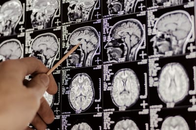 Research Story Tip: A First Look at How the Drug Salvinorin A Works in the Brain