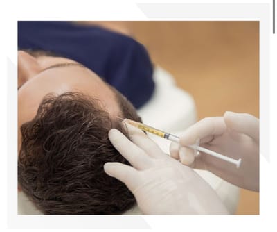 What is PRP and how does it help Hair Loss?