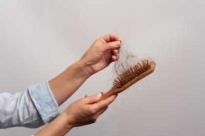 Could Endometriosis be causing my Hair Loss?