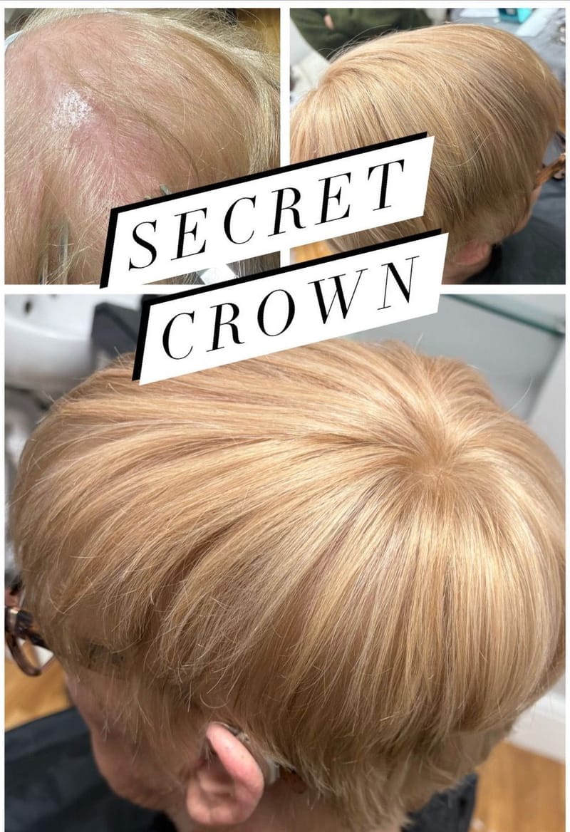 Real Hair Crowns, AirTops, Frontal frames and spot pieces