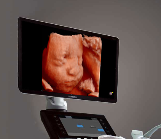 Sonography