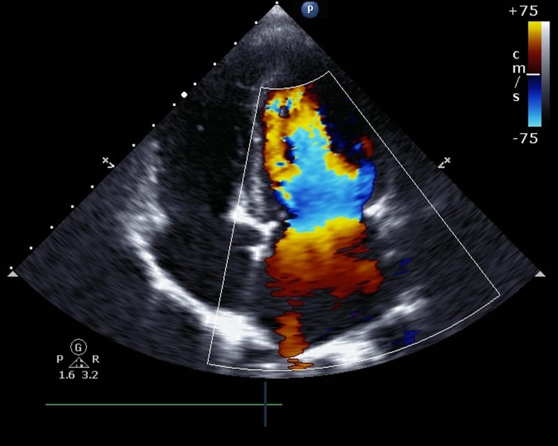 Echocardiography