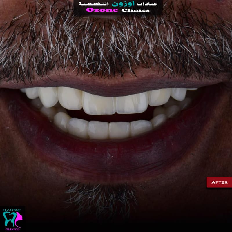 Dental