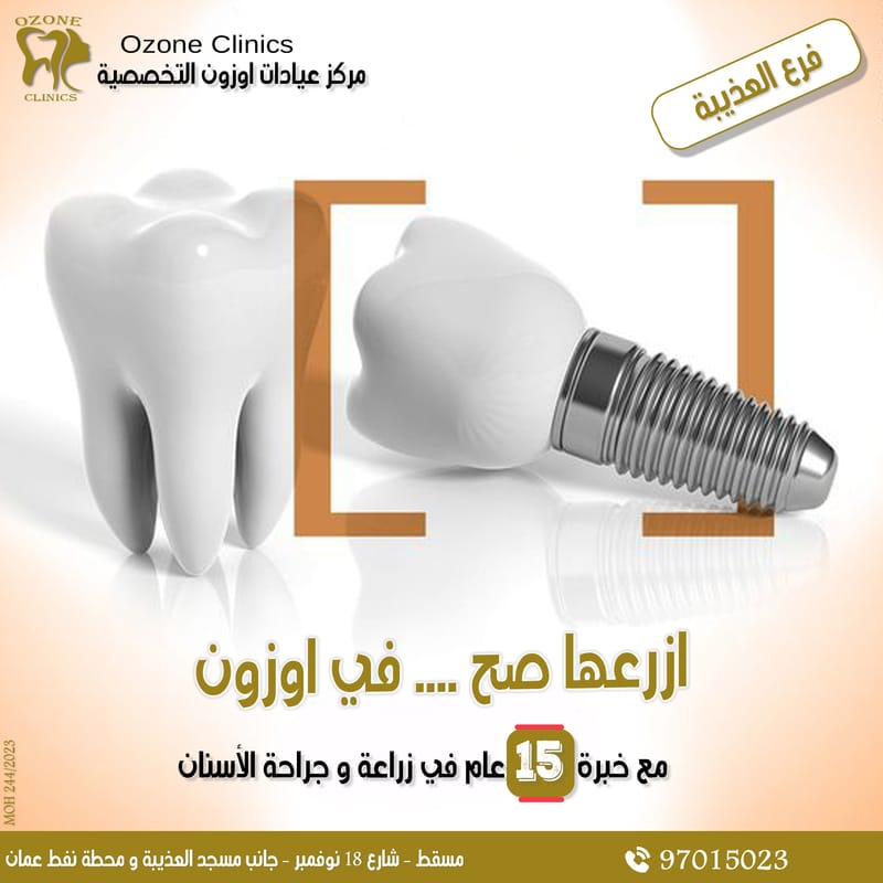 Dental implants