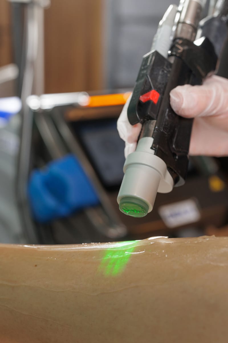 How to Find a Good Laser Hair Removal Clinic ?