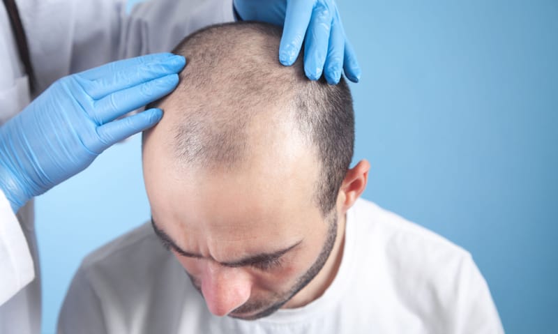 Hair transplant