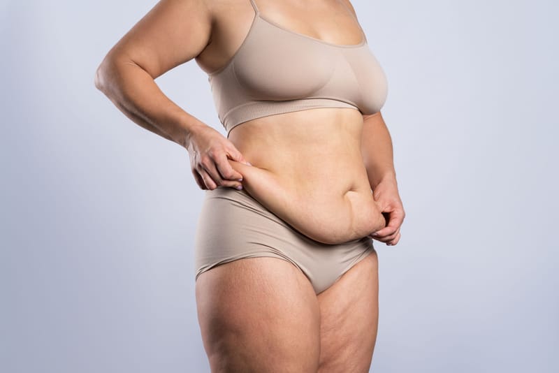 Skin Tightening & Lifting