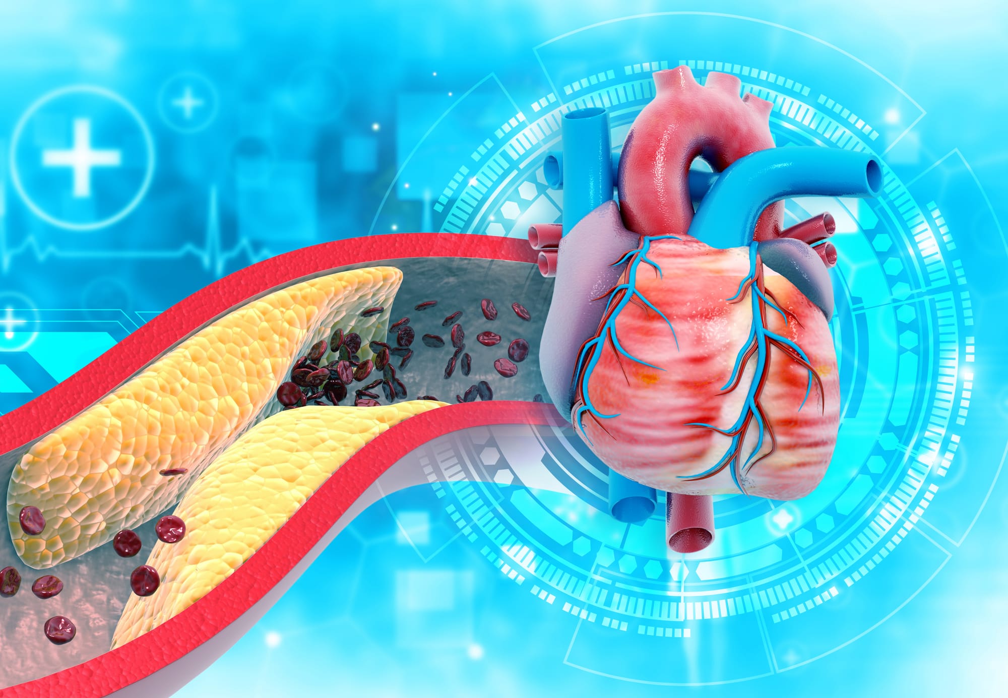 HDL Colesterol și LDL Colesterol – analize pentru identificarea riscului de boli cardiovasculare