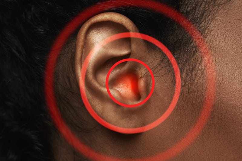 Tinnitus & Decreased Sound Tolerance Assessment